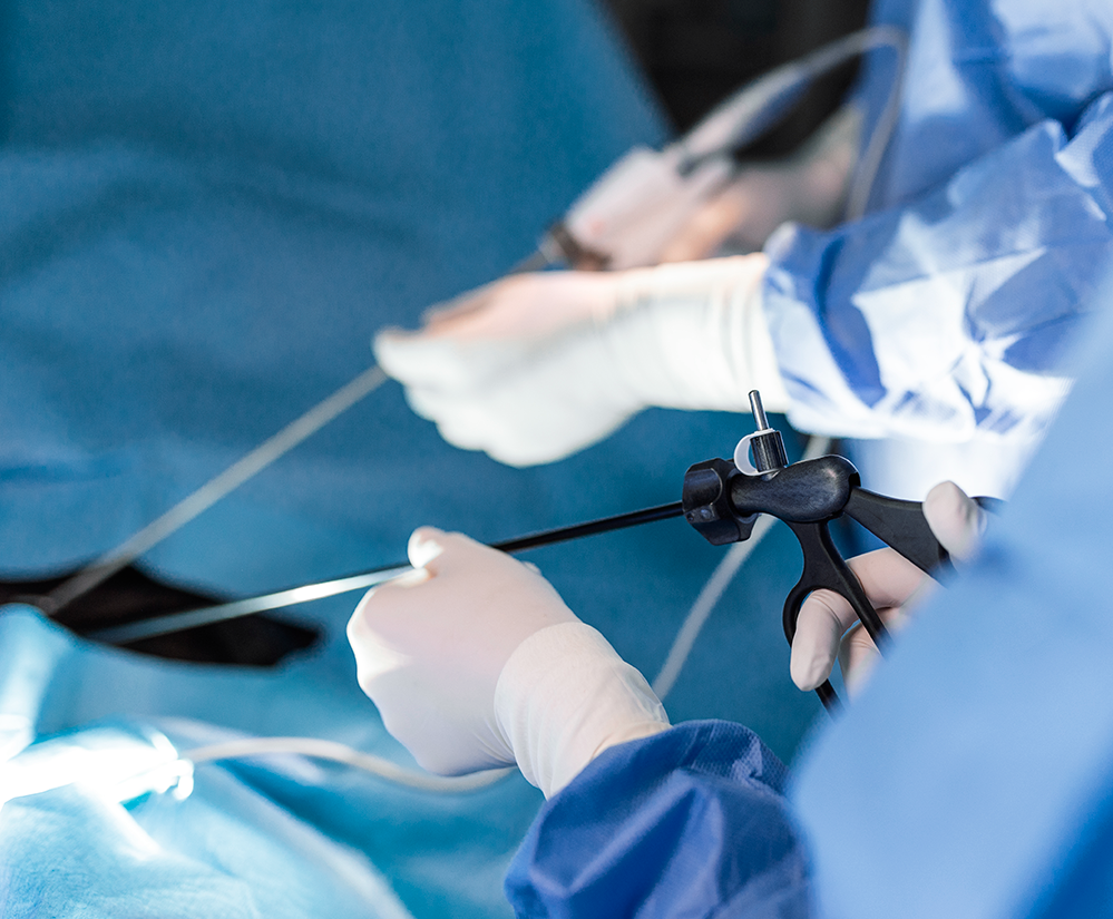 Cirurgia por vídeo